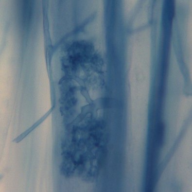 Endomykorrhiza einer Lauchwurzel 